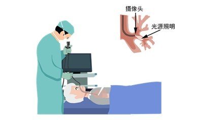 无痛支气管镜.jpg